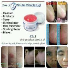 2 MinuteMiracle Gel