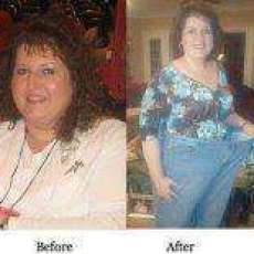 Before/After Peggy R.