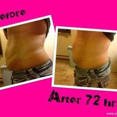 BEFORE/AFTER RESULTS