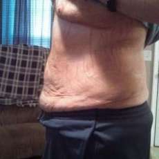 After picture using the Body Contouring Wrap