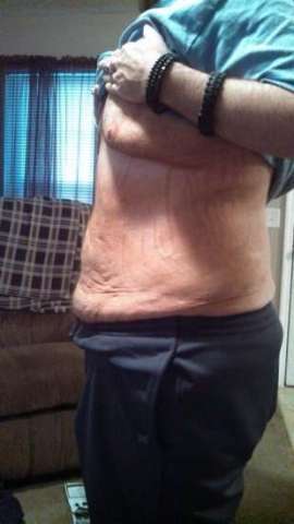 After picture using the Body Contouring Wrap