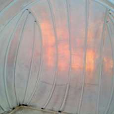 The Surgeon Implanted a Lemon Heart