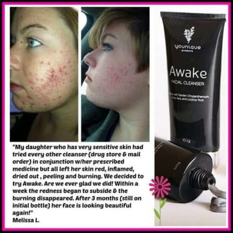 Awake Face Wash - get a clear complexion!