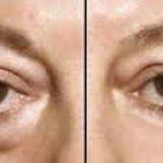 Instantly Ageless
