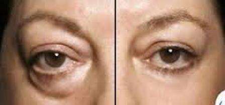 Instantly Ageless