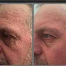 Instantly Ageless