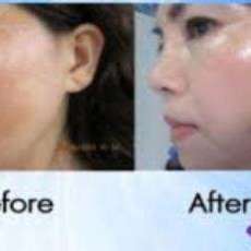Instantly Ageless