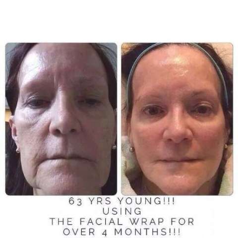 Before and After Facial Wrap