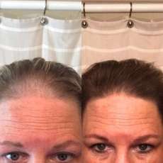 Monat Testimonies - Before and After
