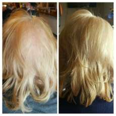 Monat Testimonies - Before and After